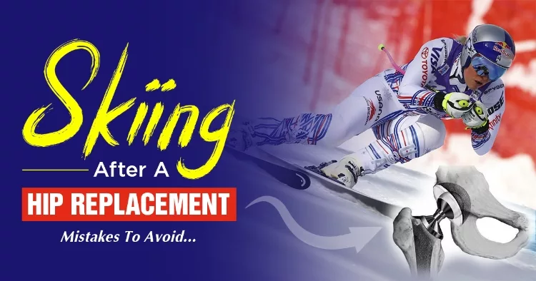 Skiing After Total Hip Replacement